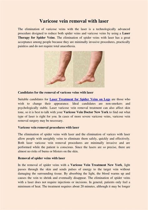 Ppt Varicose Vein Removal With Laser Powerpoint Presentation Free