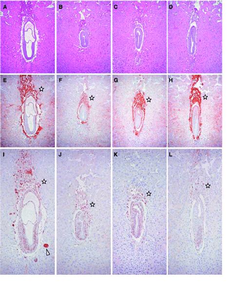 In Situ Analysis Of Dp1 Deficient Conceptuses At E7 5 Decidua