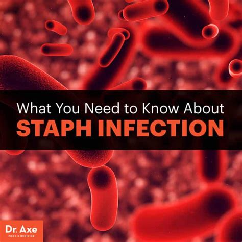 Staph Infection On Lips Treatment Lipstutorial Org