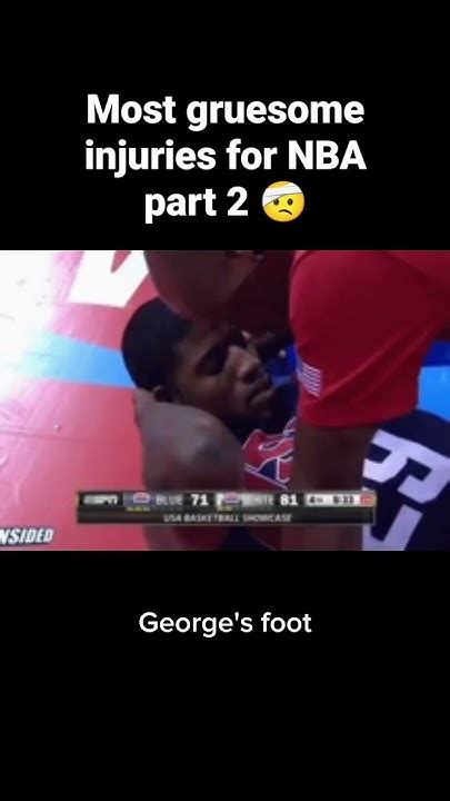 Most Gruesome Injuries For Nba Part 2 🤕nba Nbashorts Nbaplayoffs