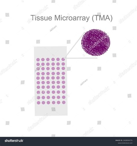 1 Genes Can Detect Cancer Stock Vectors and Vector Art | Shutterstock