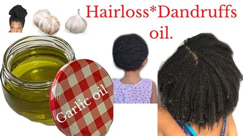 How To Make Garlic Oil For Hair Growth Hair Loss Dandruff Itchy