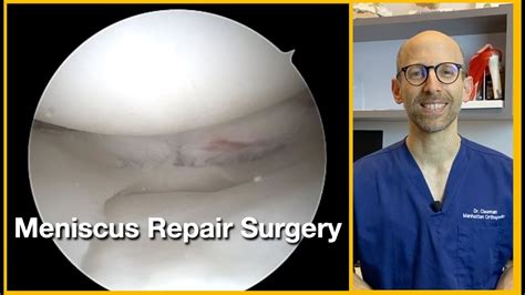 Meniscus Repair Surgical Video Bucket Handle Tear Youtube