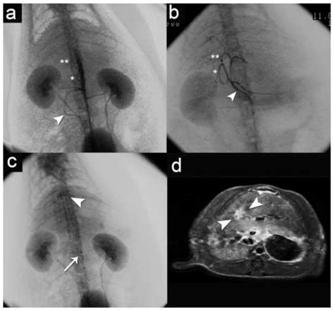 Angiography With Corresponding Post Gadolinium Enhanced Fast Spin Echo