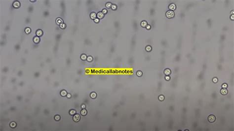 Cryptococcus Introduction Morphology Pathogenicity Lab Diag