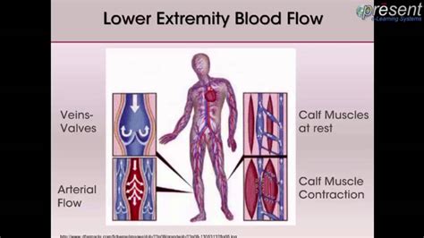 Venous Leg Ulcers Pathophysiology And Assessment Youtube