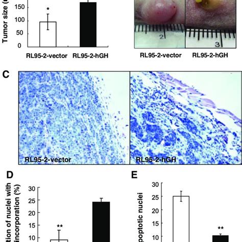 Autocrine Hgh Enhances Endometrial Carcinoma Cell Tumor Formation In