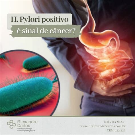 h pylori positivo é sinal de câncer Dr Alexandre Carlos