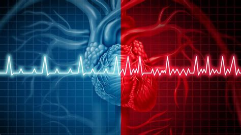 Sindrome di Brugada cos è cause sintomi diagnosi cure intervento