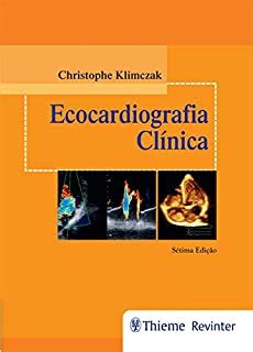 Ecocardiografia Cl Nica Ebook Resumo Ler Online E Pdf Por