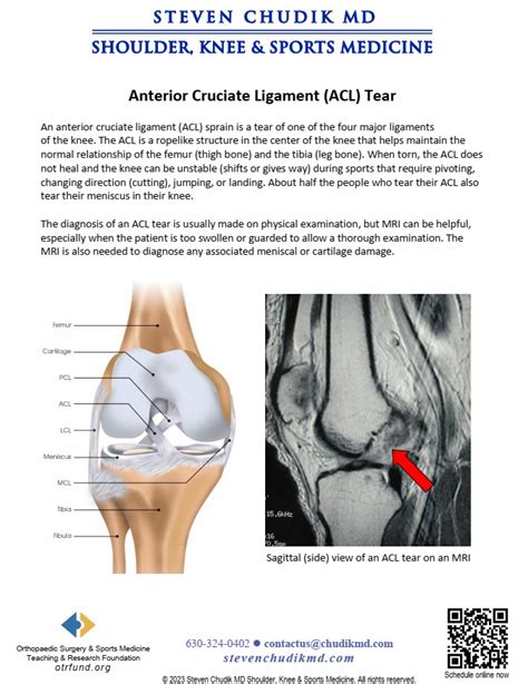 Anterior Cruciate Ligament Acl Injuries Steven Chudik Md