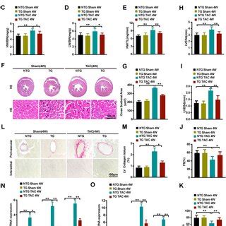 Cardiac Specific Dusp Overexpression Attenuated Tac Induced Cardiac