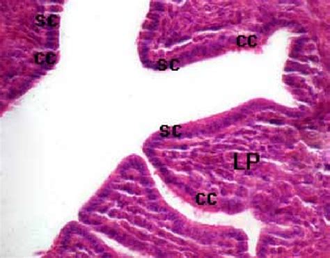 Simple Columnar Ciliated Epithelium Fallopian Tube