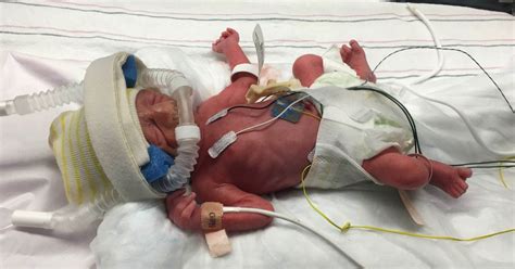 Newborn Premature Baby Boy