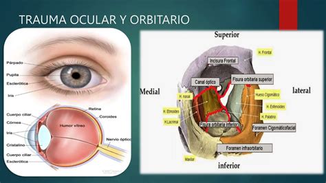 Trauma Ocular Pptx Descarga Gratuita