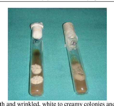 Figure 1 From Determination Of Growth Curve Of Sporothrix Schenckii In