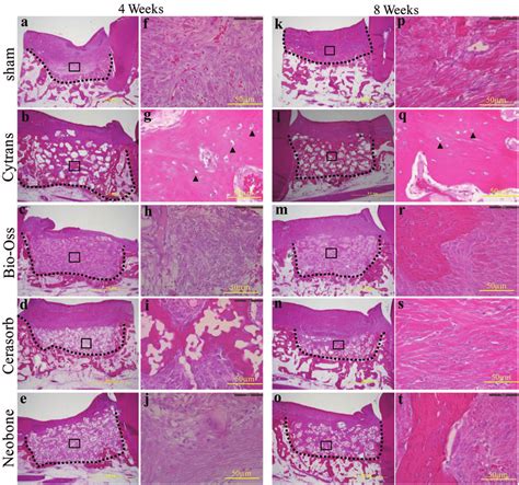 Histology Of New Bone Formation In The Defect Area Evaluated By HE