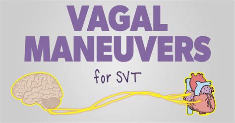 Vagal Maneuvers: How to Stop your Patient’s SVT | Health And Willness