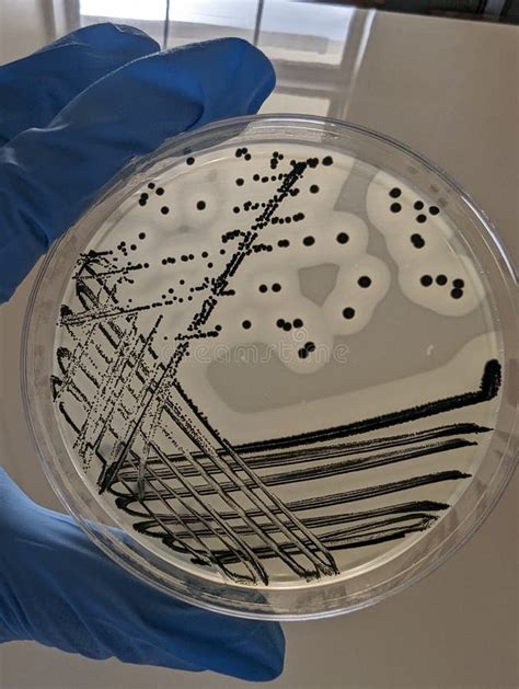 Quadrant Streak Of Staphylococcus Aureus On Baird Parker Agar Plate