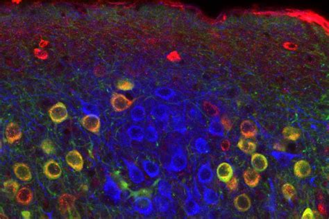 How the brain encodes time and place | MIT News | Massachusetts Institute of Technology