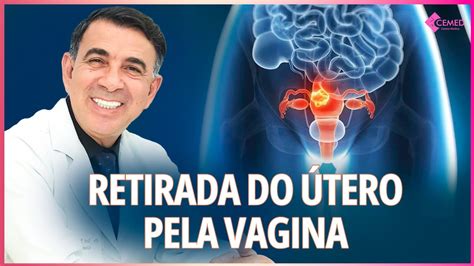 Cirurgia De Retirada Do Tero Pela Vagina Histerectomia Por Via