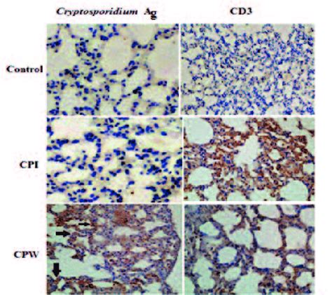 Immunohistochemical Analysis Of Cryptosporidium Antigen And Cd3 Download Scientific Diagram