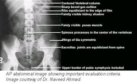 Ap Abdominal Projection X Ray Positioning Techniques Auntminnie