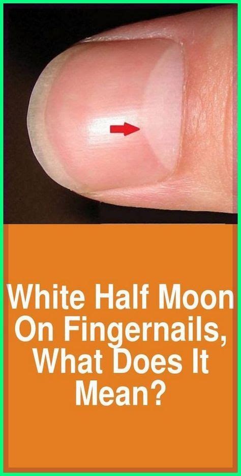 10 Disturbing Things Your Nails Reveal About Your Health Artofit