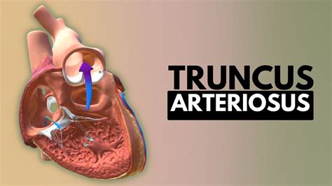 Truncus Arteriosus Causes Signs And Symptoms Diagnosis And Treatment