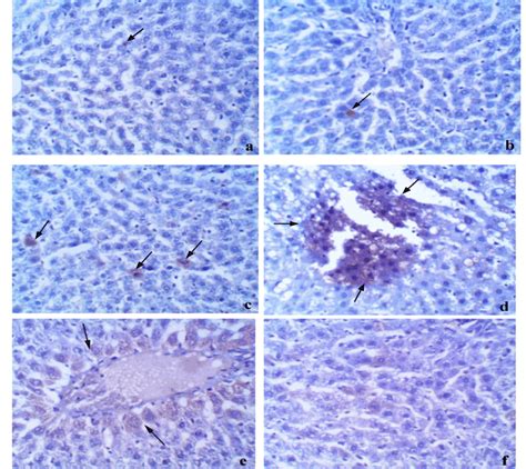 Photomicrographs Of Liver Sections Stained With Caspase 3 A Group1