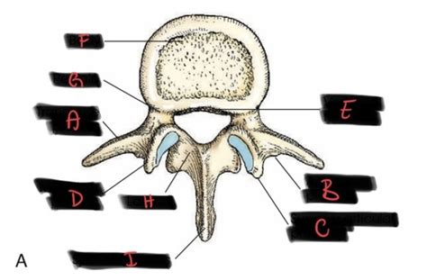 Spine Anatomy L Spine Specific Flashcards Quizlet