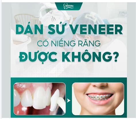 D N S Veneer C Ni Ng R Ng C Kh Ng