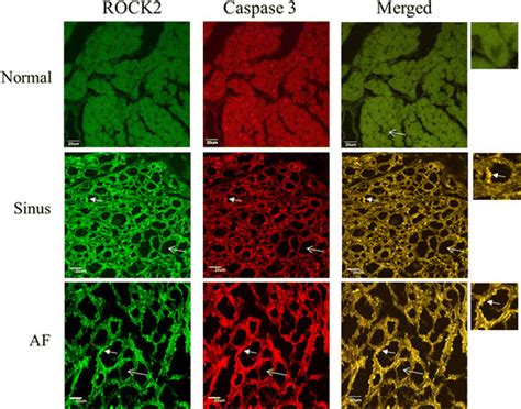 Confocal Images Of The Expression Of ROCK2 Green Color And Cleaved