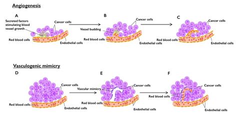 Angiogenesis Versus Vasculogenic Mimicry Vm In The Tumorigenesis Of