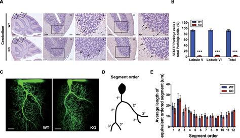 Figures And Data In Ablation Of Stat In Purkinje Cells Reorganizes