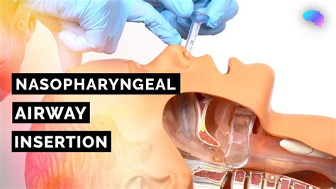 Nasopharyngeal Airway NPA Insertion ABCDE Emergency OSCE Guide