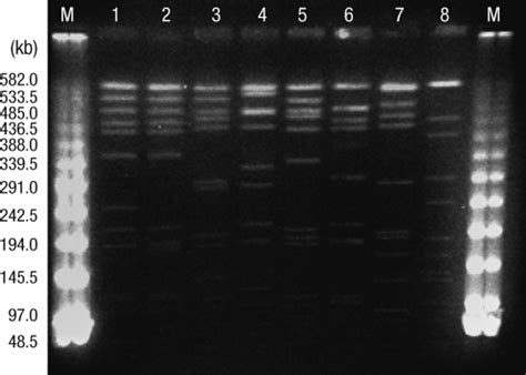 Pulsed Field Gel Electrophoresis PFGE Patterns Of MRSA Isolate From