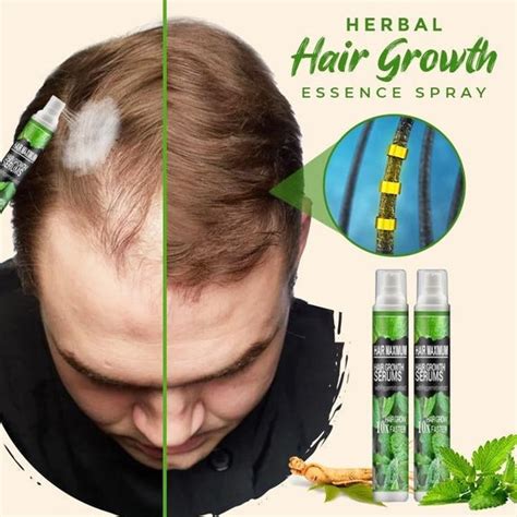 Herbal Hair Growth Essence Spray Thedealzninja