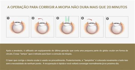 Tudo O Que Voc Precisa Saber Sobre A Cirurgia De Miopia Holhos Prime