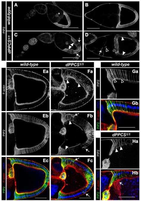 Ptdins P Localization And Expression Is Affected In Dppcs We