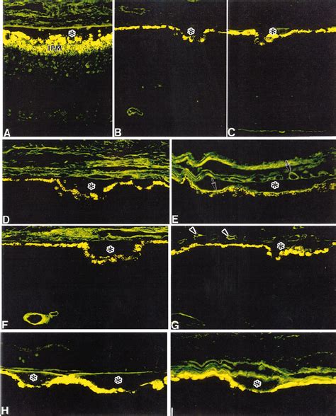 Fluorescence Light Micrographs Of Sections Derived From Human Donor