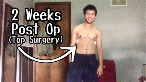 Post Op Top Surgery Care