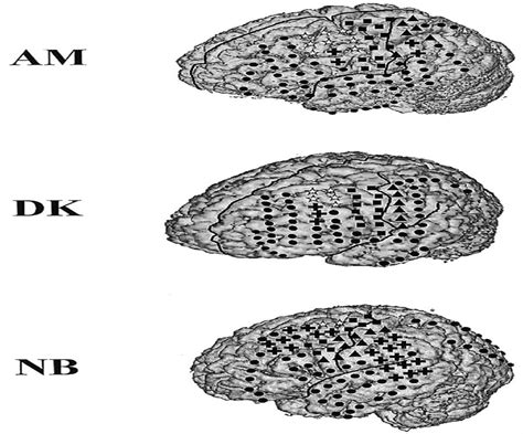 NeuroReport