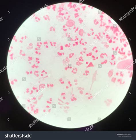 Diplococci Gram Negative Bacteria 1
