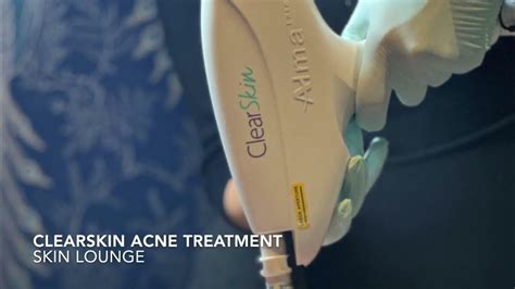 Clearskin Acne Laser Treatment Youtube