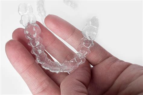 Can Invisalign Fix An Underbite