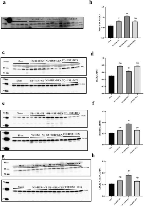 Effect Of Dexmedetomidine Dex Injection On Autophagy Marker Proteins