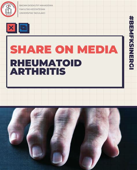 Rheumatoid Arthritis Bem Km Fk Untad 2024