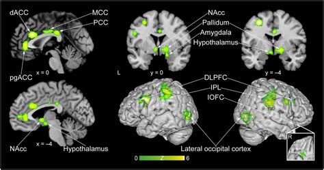 Neural Substrates Of Sexual Arousal Revisited Dependent On Sex Pnas