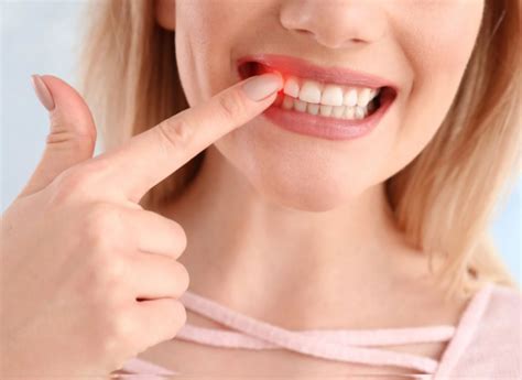 Receding Gums Causes Symptoms And Treatment Options Nova Di